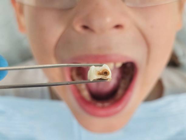 Best Walk-In Emergency Dental Services in Holt, MI